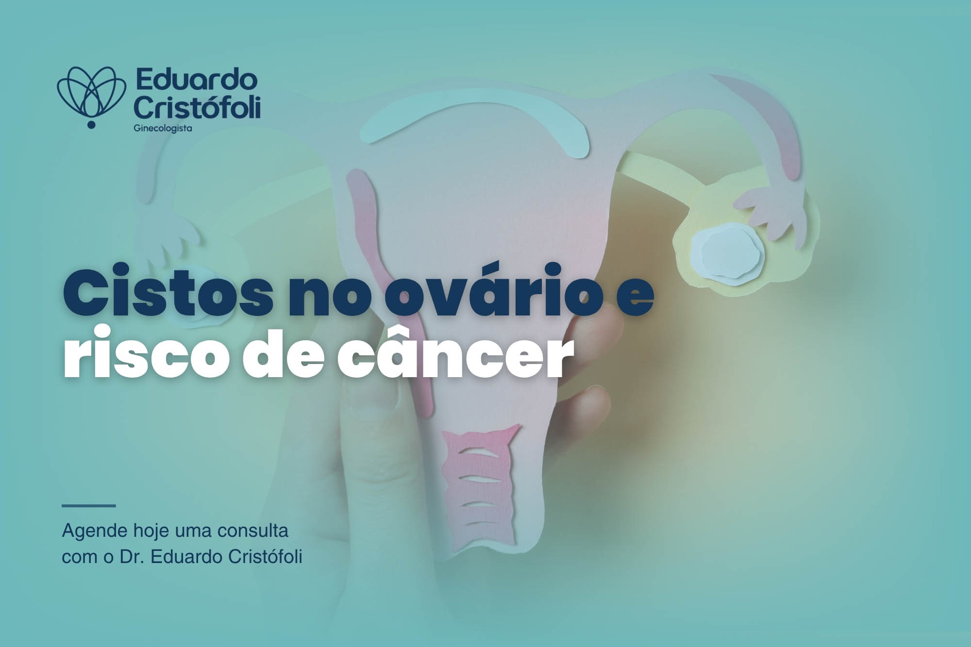 Cistos no ovário e risco de câncer: quando a atenção faz toda a diferença