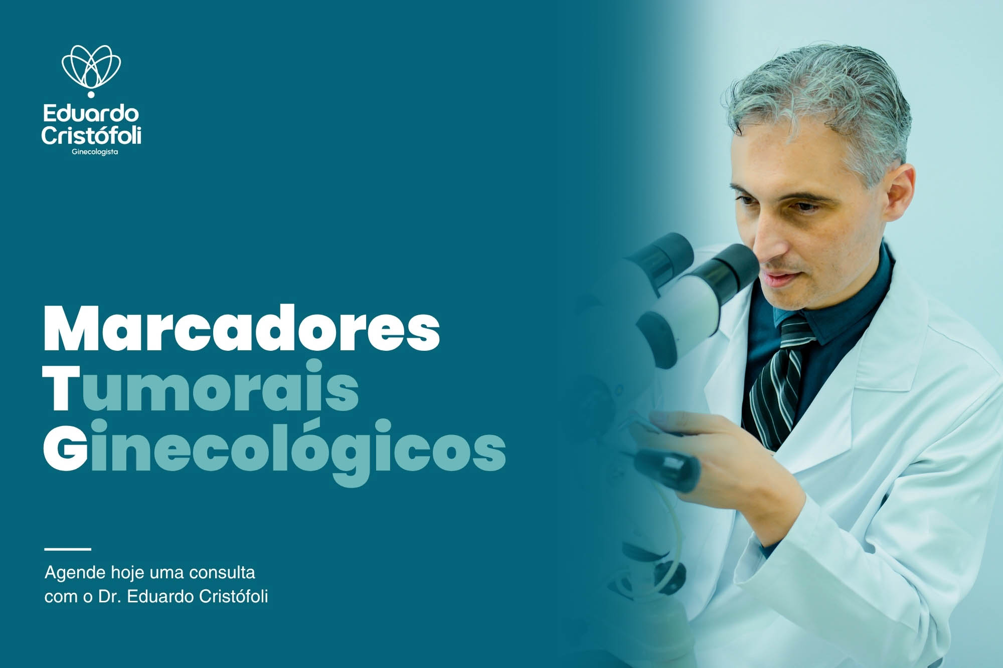 Marcadores tumorais ginecológicos: entenda sinais e a importância do exame
