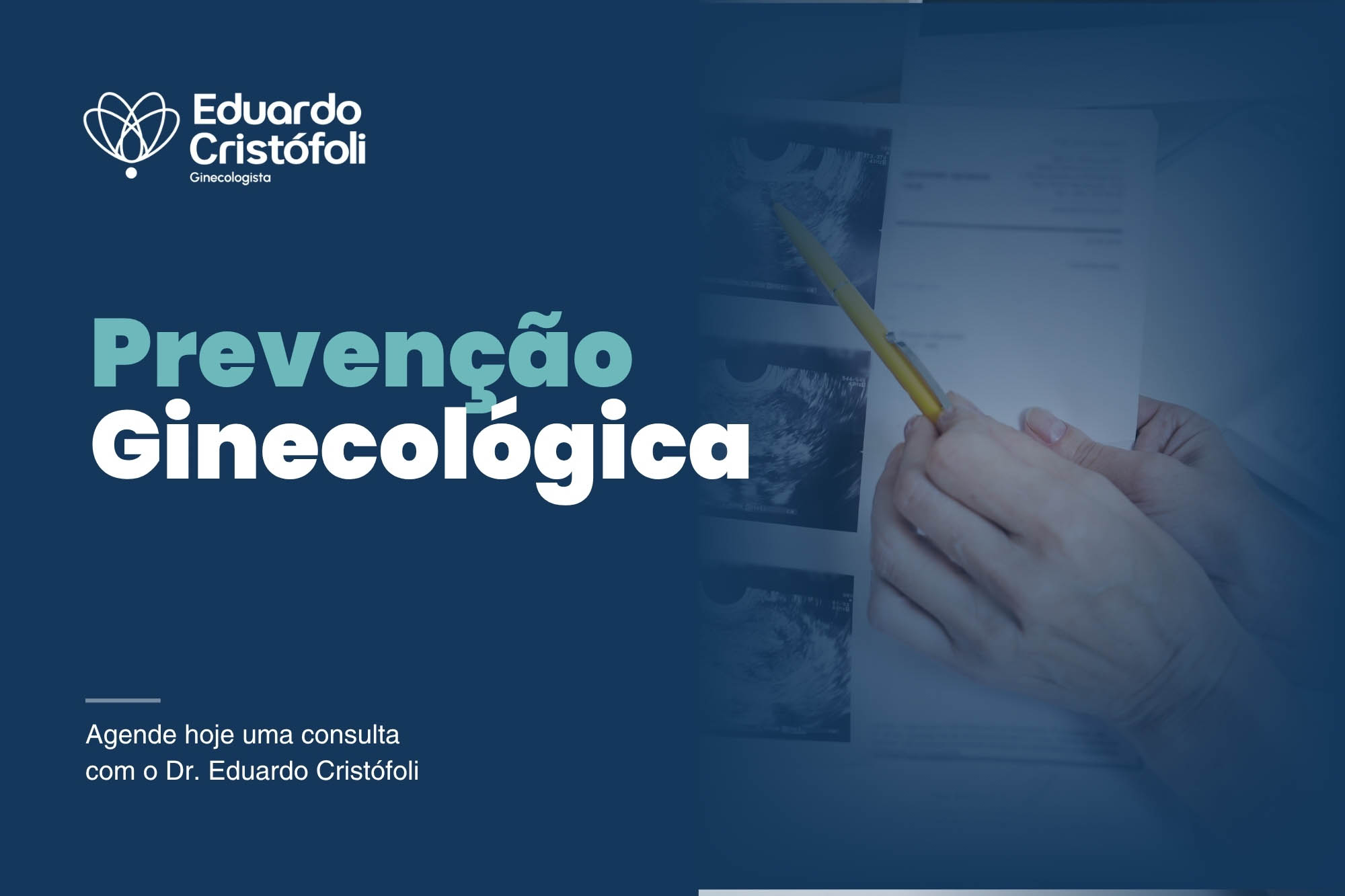 Prevenção ginecológica: como cuidar da saúde íntima antes de qualquer sinal